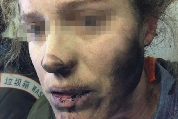 Bu da oldu ! Kulaklık bomba gibi patladı